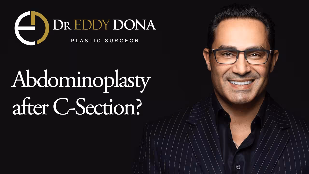 Tummy Tuck (Abdominoplasty) After Caesarean Section
