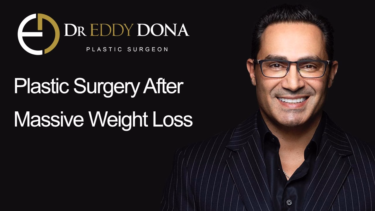 Plastic Surgery After Weight Loss