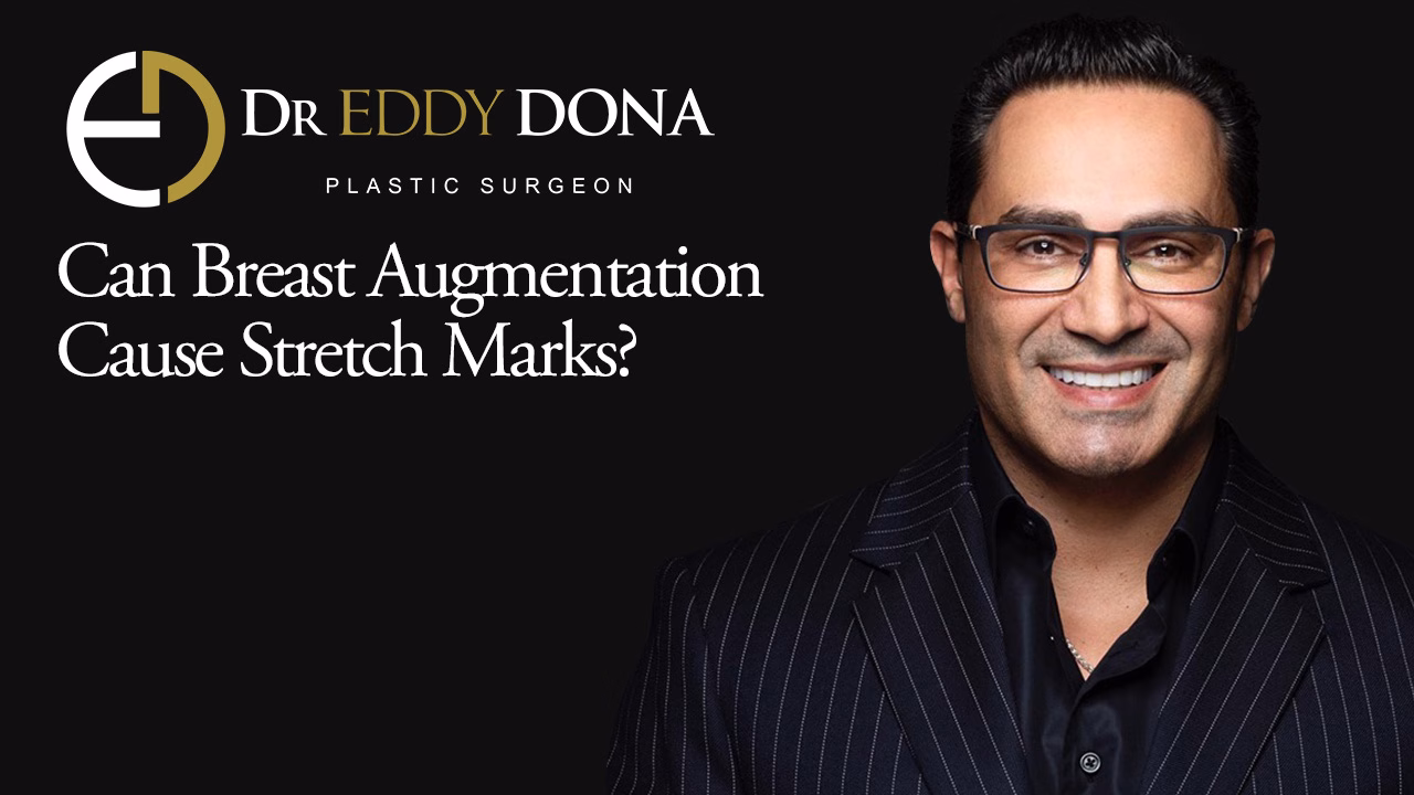 Can Breast Augmentation Cause Stretch Marks?