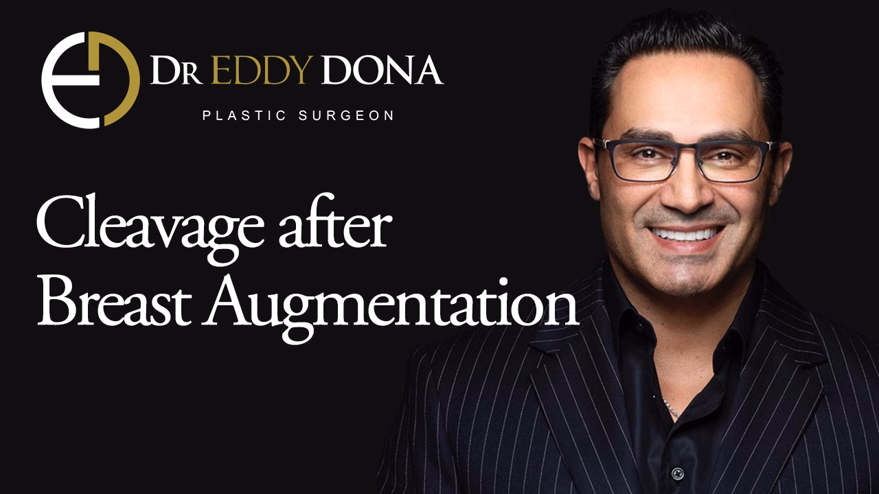 Cleavage After Breast Augmentation