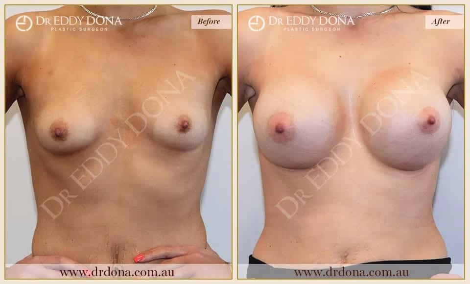 Case 5