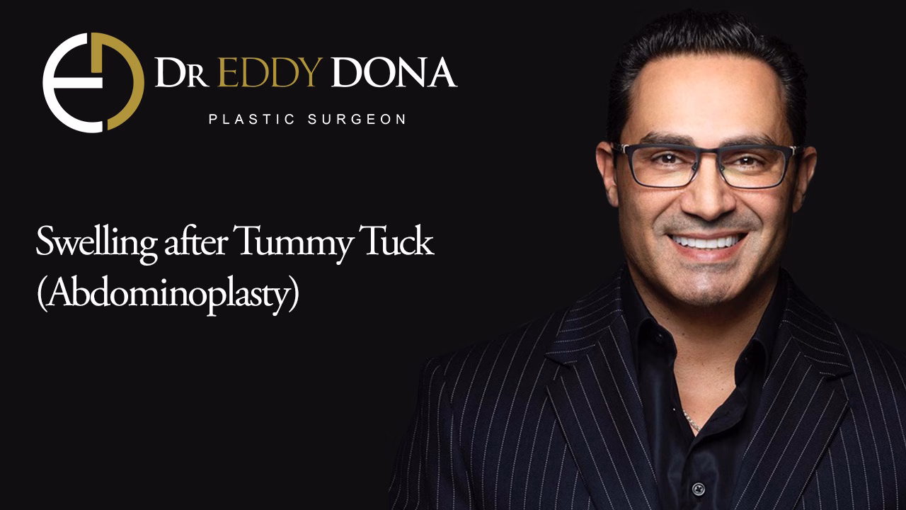 Swelling after Tummy Tuck (Abdominoplasty)