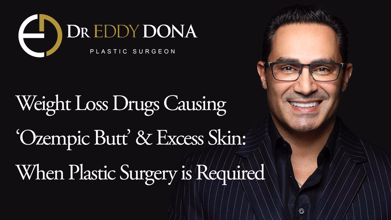 Weight Loss Drugs Causing ‘Ozempic Butt’ & Excess Skin: When Plastic Surgery is Required