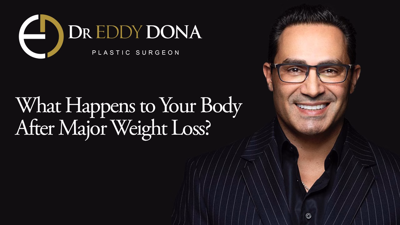 What Happens to Your Body After Major Weight Loss?